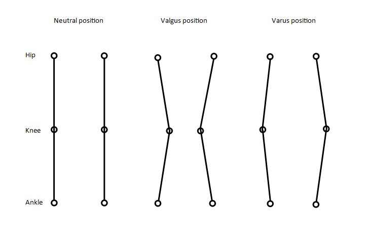Valgus/Varus angles